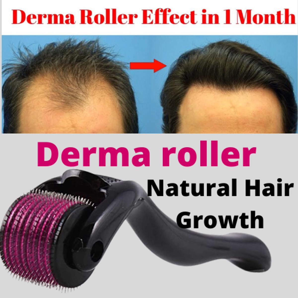 derma-roller-hair-therapy-micro-needle-derma-roller-for-hair-re-growth-amp-skin-for-male-and-female-05mm_PD6277