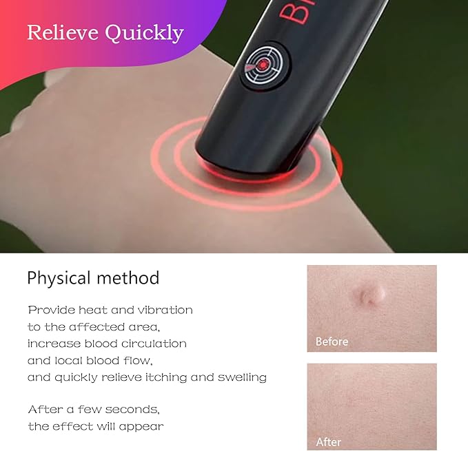 mosquito-bite-helper---insect-bite-relief-useful-for-summer-helps-children-insect-bites-adults-irritation-itching-neutralizer-relieve-stings-cell-operated_PD5760