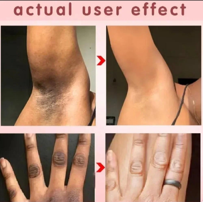 whitening-cream-for-sensitive-areas-underarm-and-private-areas---30g_PD4797