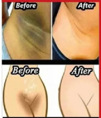 whitening-cream-for-sensitive-areas-underarm-and-private-areas---30g_PD4797