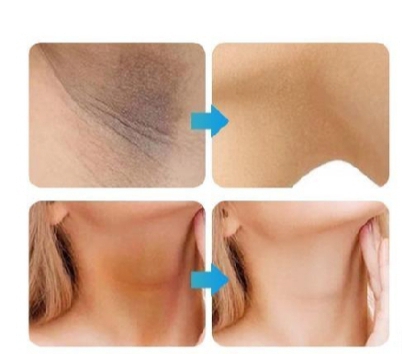 whitening-cream-for-sensitive-areas-underarm-and-private-areas---30g_PD4797
