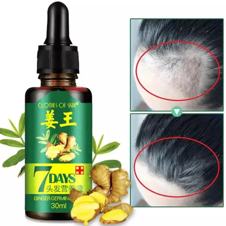 original-7-days-hair-growth-germinal-serum-oil-30ml_PD5168