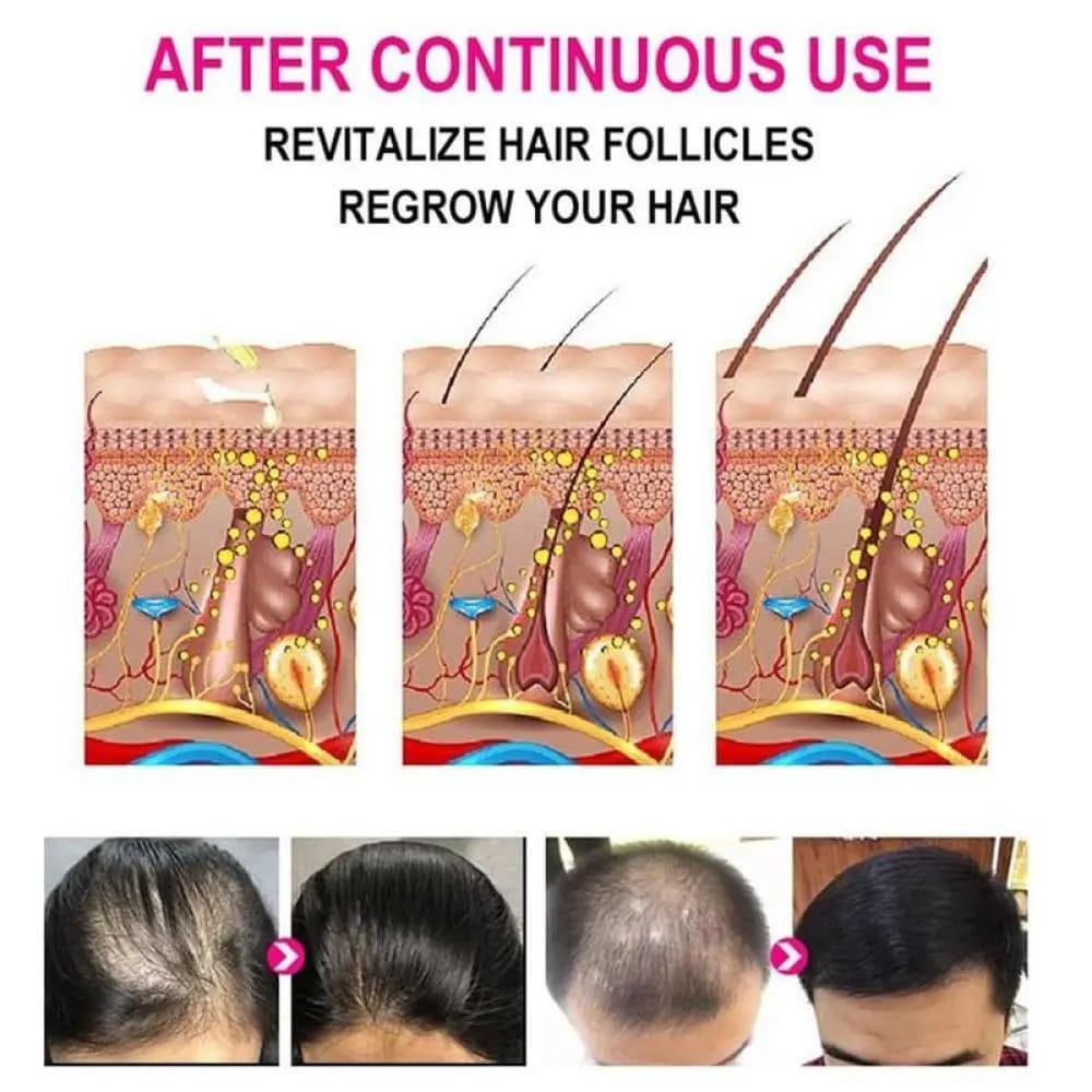 anti-grey-hair-serum-30ml_PD4326