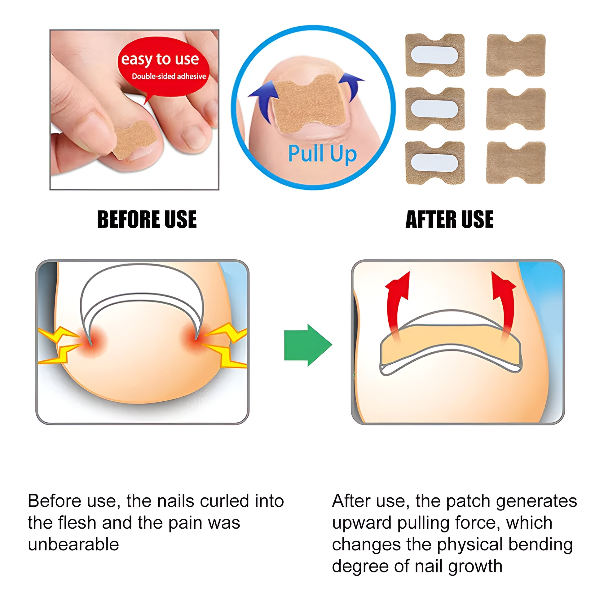 30-pcs---glue-free-ingrow-toenail-corrector-stickers-ingrown-toe-nail-pain-reliever-patches_PD4735