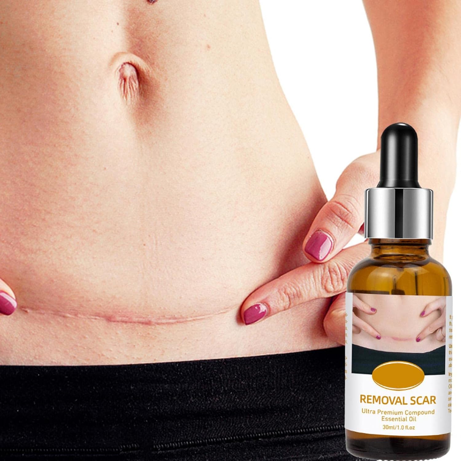 acne-scar-removal-rejuvenation-serum-scar-c-section-amp-stretch-mark-removal-oil-for-women_PD2770