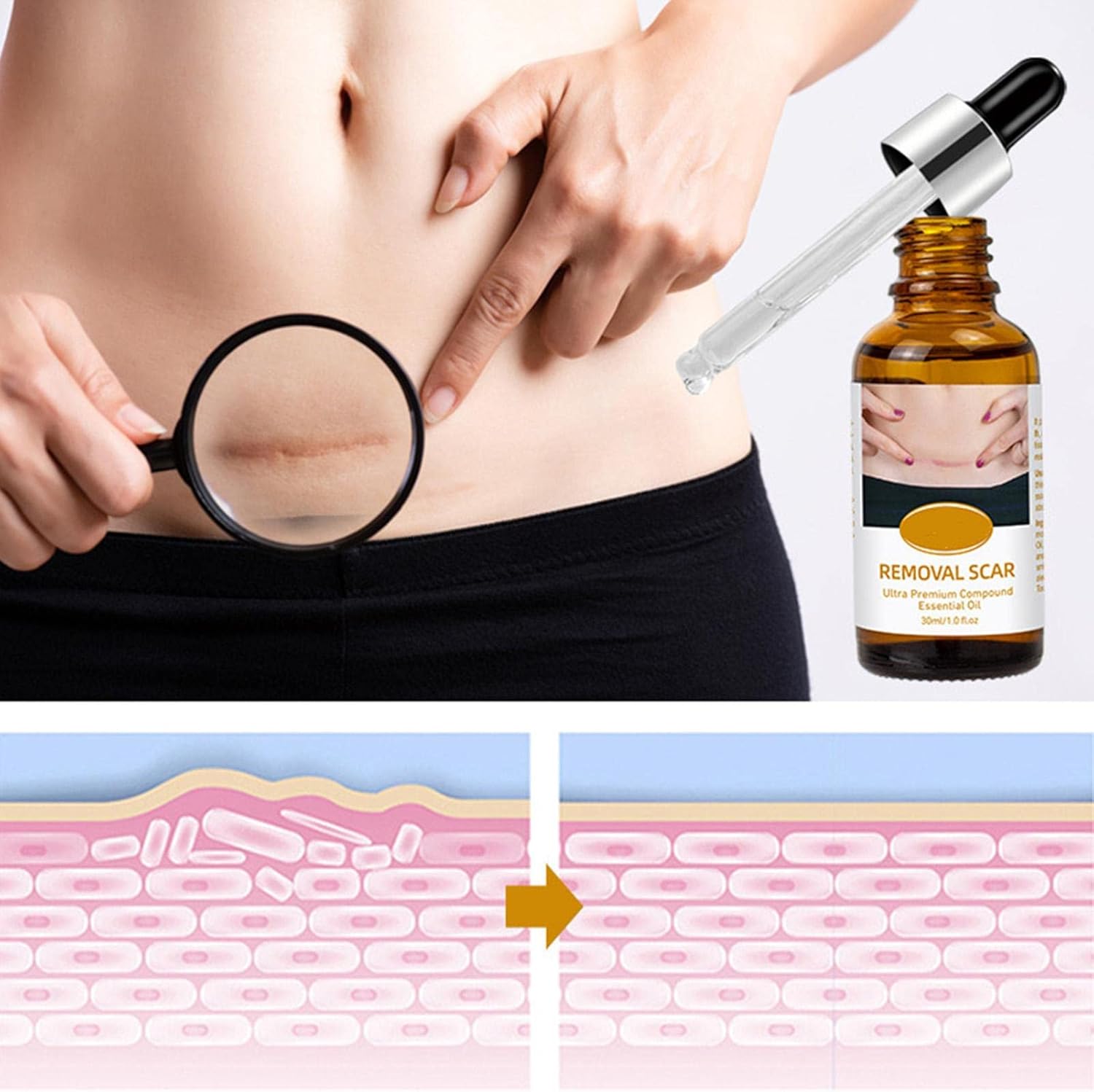 acne-scar-removal-rejuvenation-serum-scar-c-section-amp-stretch-mark-removal-oil-for-women_PD2770