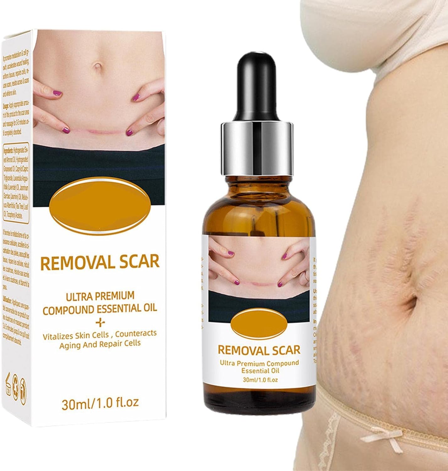 acne-scar-removal-rejuvenation-serum-scar-c-section-amp-stretch-mark-removal-oil-for-women_PD2770