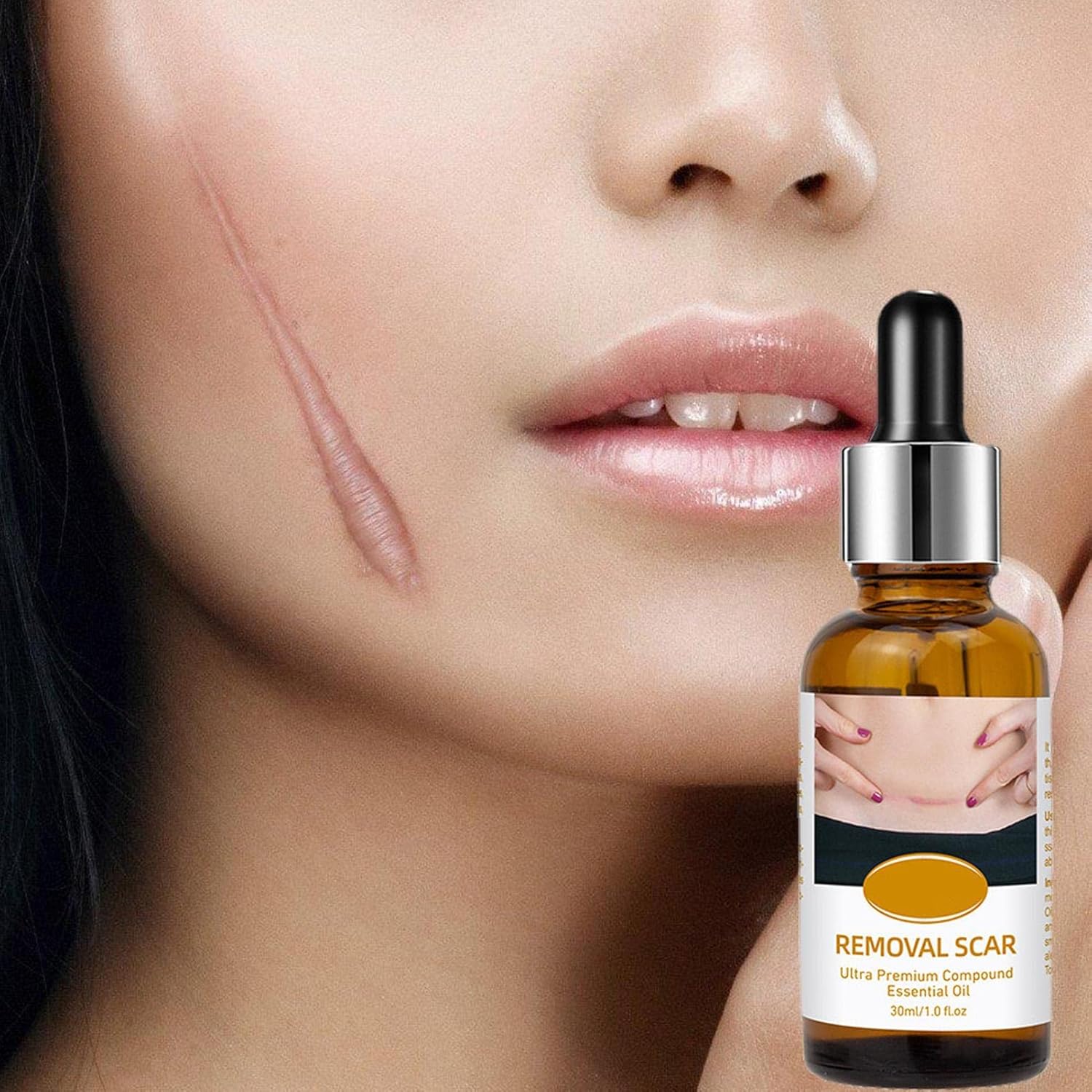 acne-scar-removal-rejuvenation-serum-scar-c-section-amp-stretch-mark-removal-oil-for-women_PD2770