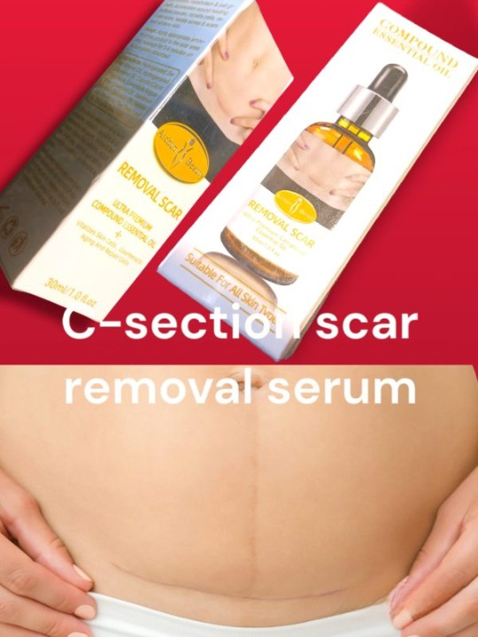 acne-scar-removal-rejuvenation-serum-scar-c-section-amp-stretch-mark-removal-oil-for-women_PD2770