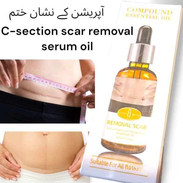 acne-scar-removal-rejuvenation-serum-scar-c-section-amp-stretch-mark-removal-oil-for-women_PD2770