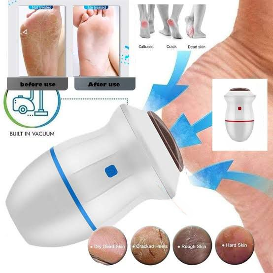 find-back-electric-foot-vacuum-callus-remover-cell-operate_PD3887