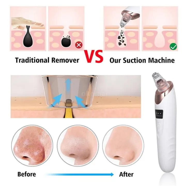 face-vacuum-blackhead-remover-pore-cleaner-electric-deep-cleansing-tool-for-nose-amp-face_PD2494