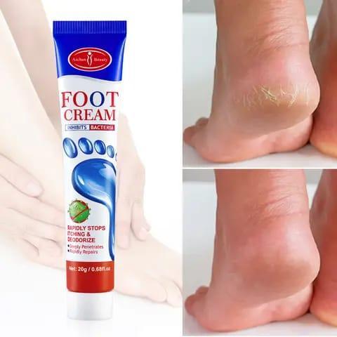 aichun-beauty-moisturizing-foot-cream-dead-skin-care-cream-foot-removal-cream-for-cracked-heels-20g-ac2042_PD2815