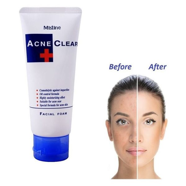 mistine-acne-clear-face-wash-facial-foam-85-ml_PD2816