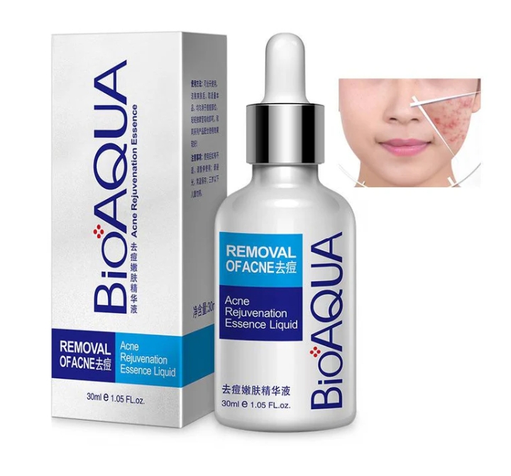 bioaqua-anti-acne-serum-removal-of-acne-essence-liquid-30ml_PD1800