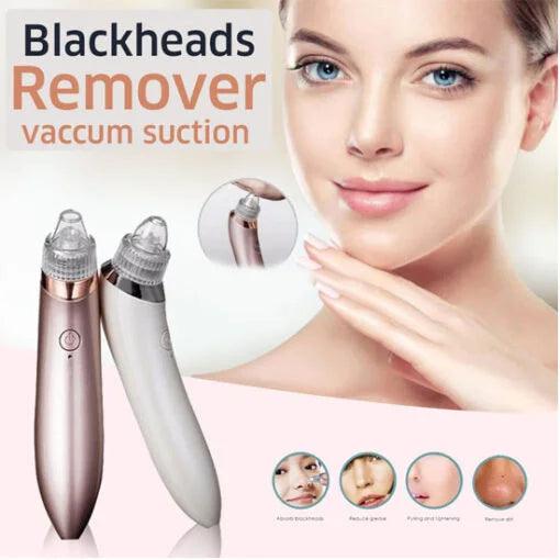 face-vacuum-blackhead-remover-pore-cleaner-electric-deep-cleansing-tool-for-nose-amp-face_PD2069