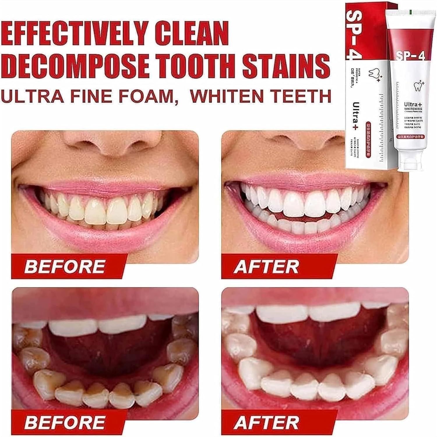 yayashi-sp-4-ultra-whitening-toothpaste-probiotic-stain-remover-stain-removing-toothpaste-protects-gums-freshens-breath-for-everyone_PD7787