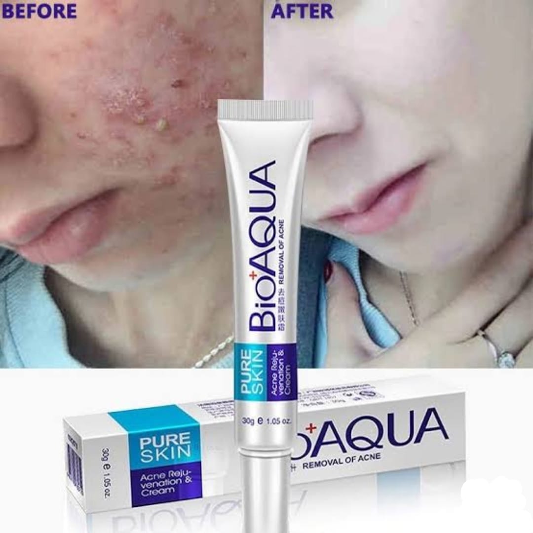 bioaqua-anti-acne-cream-acne-scar-removal-cream-best-quality-scar-removal-cream-original_PD8082