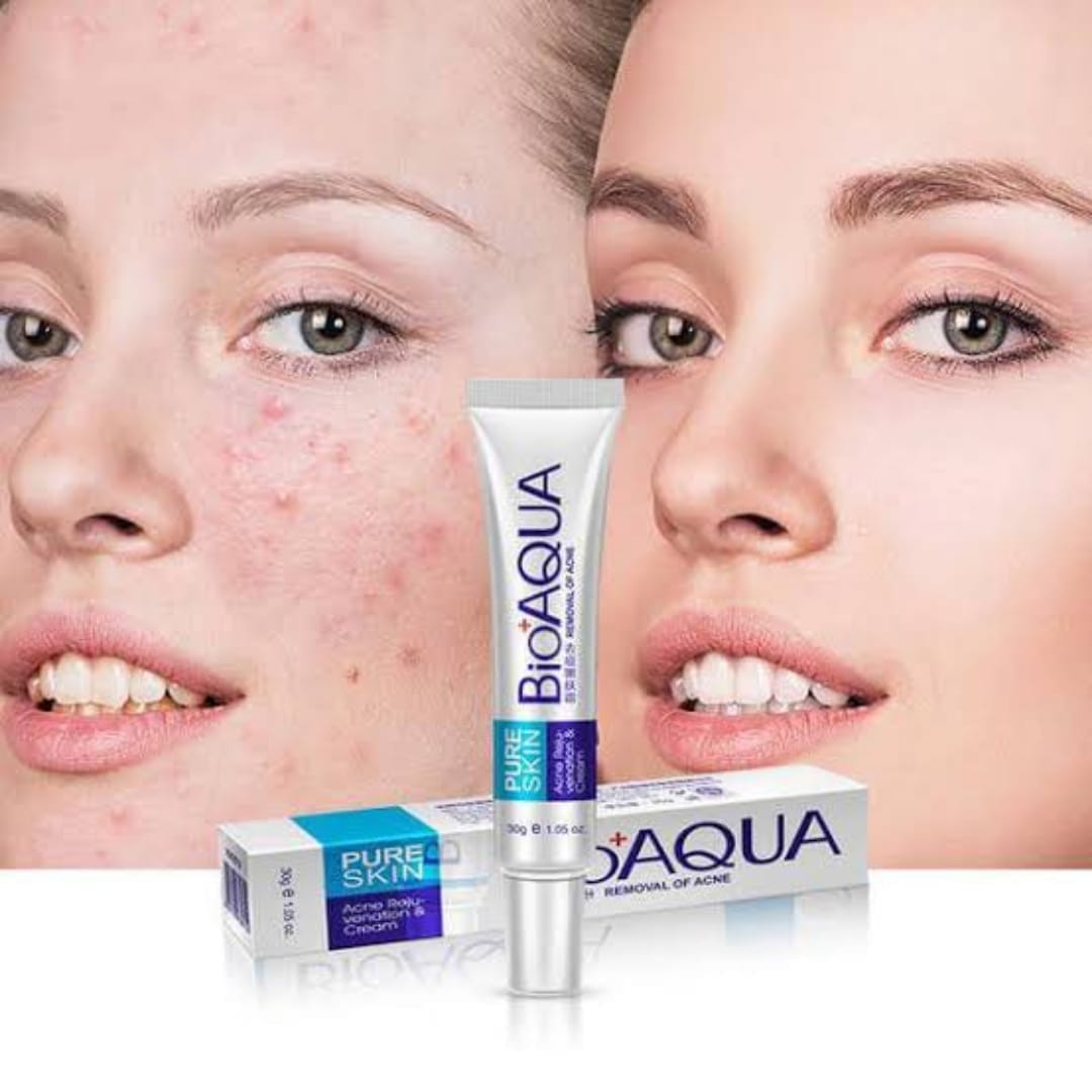 bioaqua-anti-acne-cream-acne-scar-removal-cream-best-quality-scar-removal-cream-original_PD8082