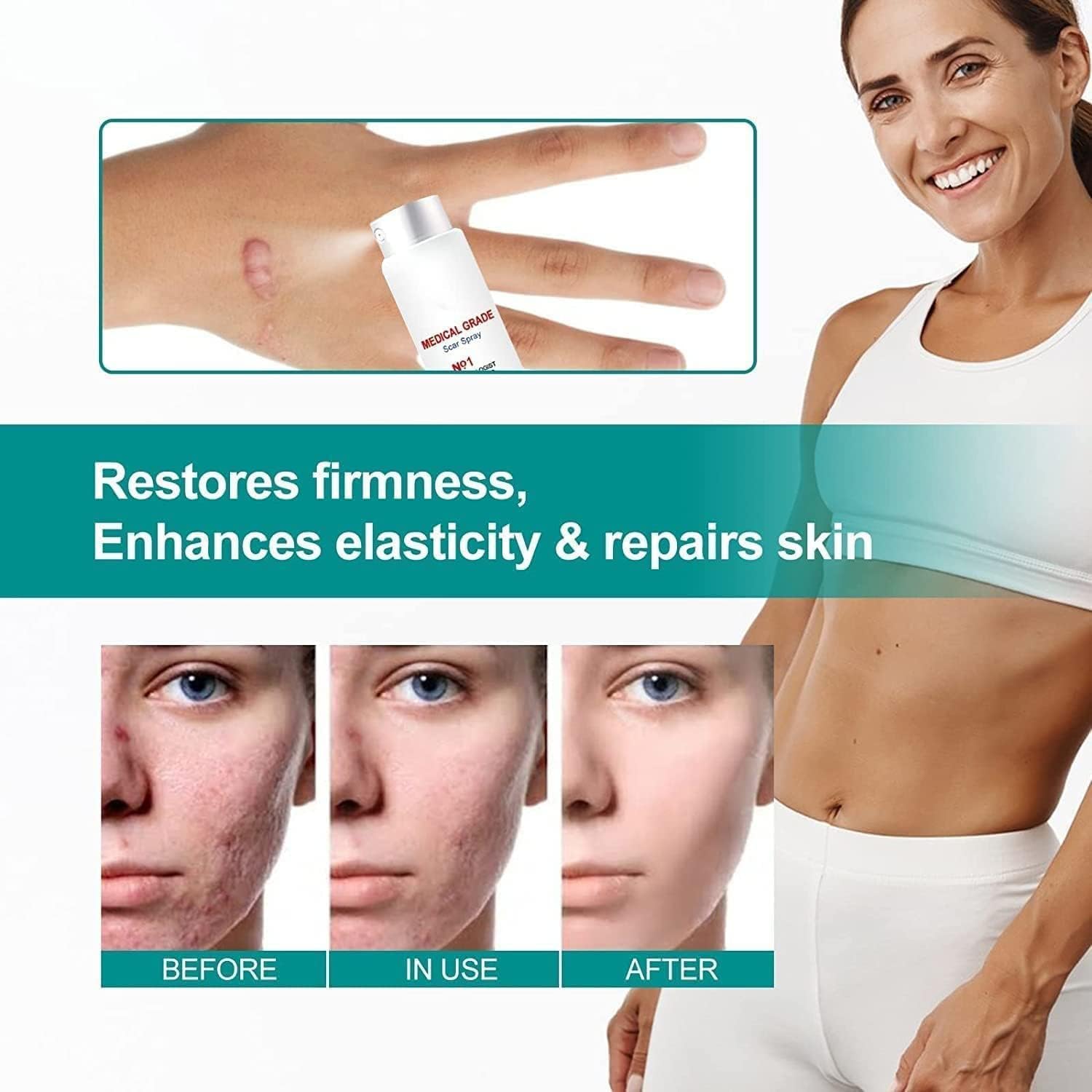 scar-removescar-remove-medical-grade-scar-spraymedical-grade-scar-removal-sprayscar-removal-sprayscar-remove-sprayscar-sprayadvanced-acne-scar-treatment-for-face-1pcs_PD8648