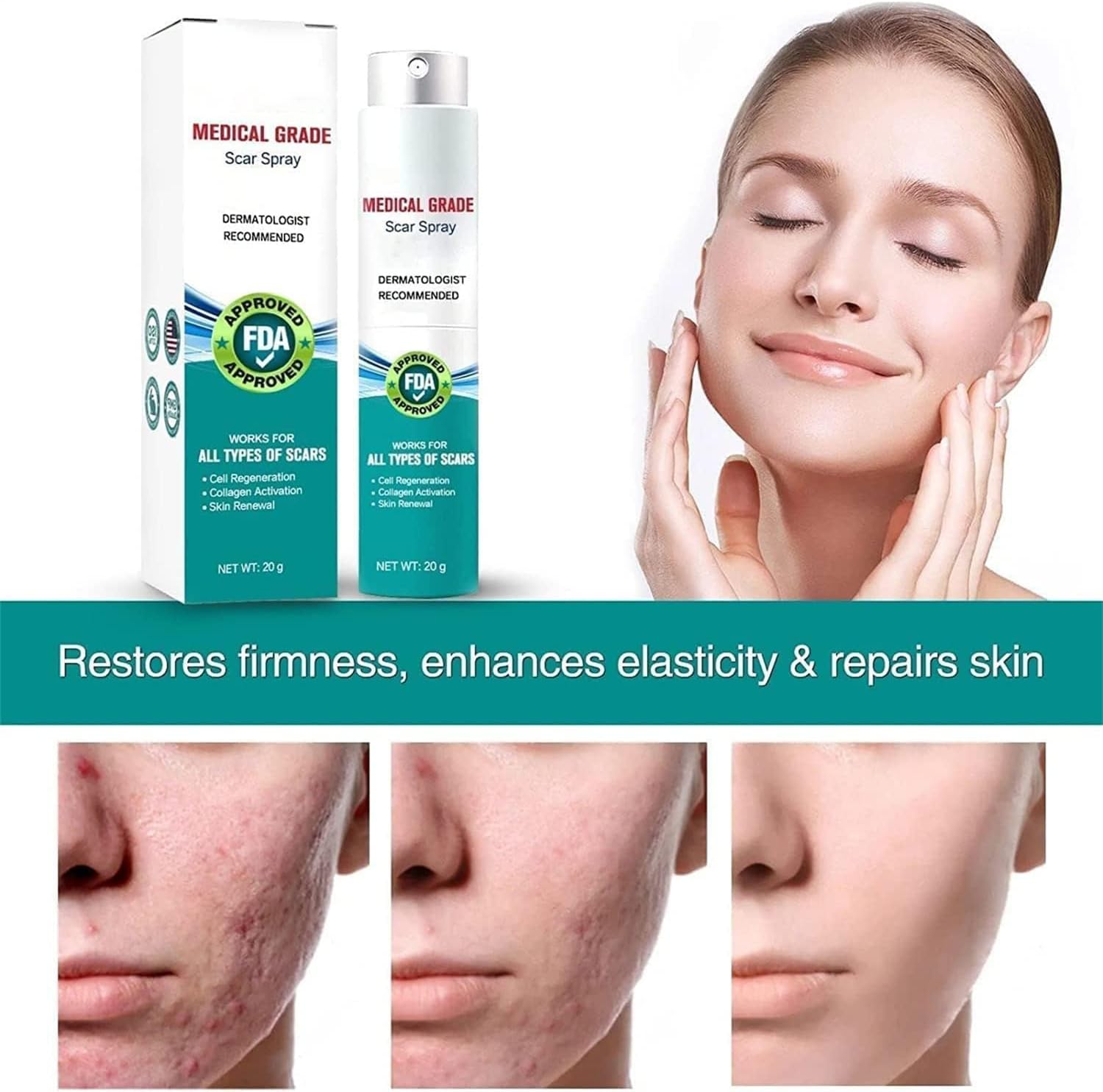 scar-removescar-remove-medical-grade-scar-spraymedical-grade-scar-removal-sprayscar-removal-sprayscar-remove-sprayscar-sprayadvanced-acne-scar-treatment-for-face-1pcs_PD8648